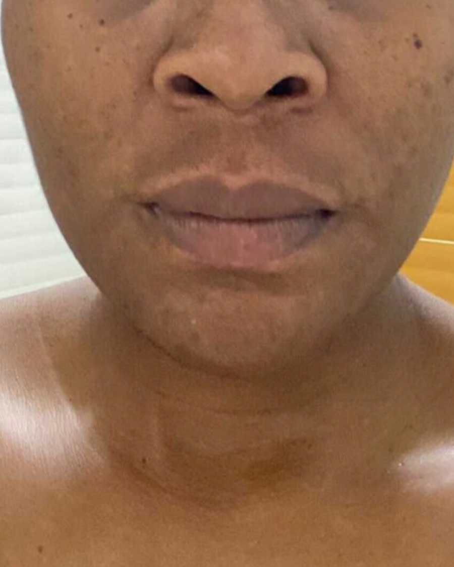 SENSITIVE & STRESSED SKIN